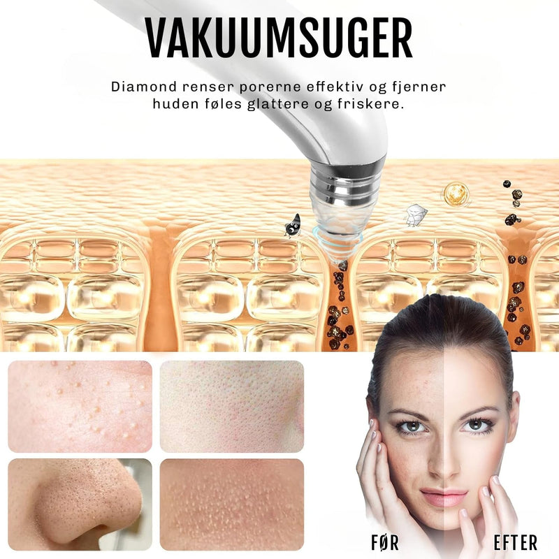 Hudormesæt Performance 2.0