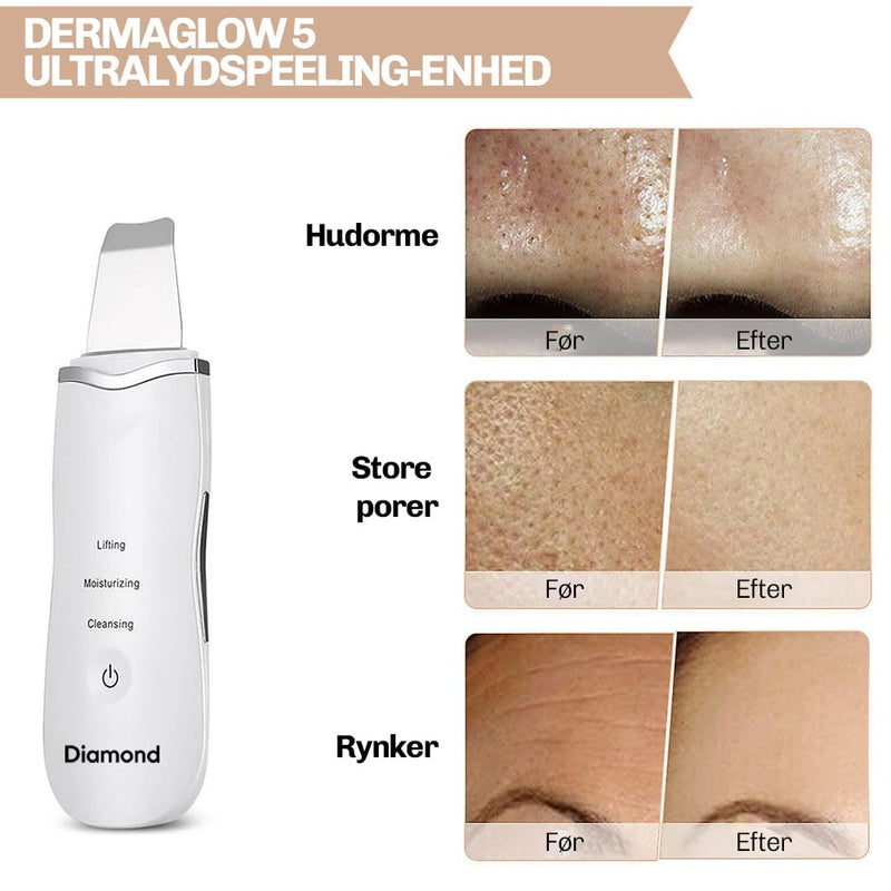 Ultralyd Peeling DermaGlow 5