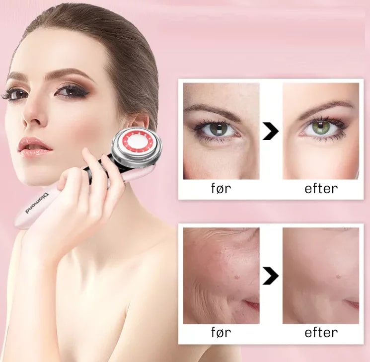 EMS Ansigtsmassager GlowLift