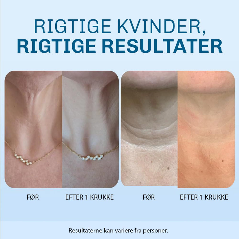 Liftingcreme mod halsrynker